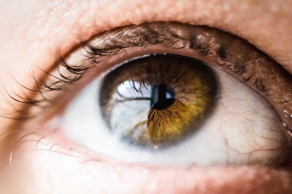 beautiful, close-up, eye -how to soothe irritated skin around eyes