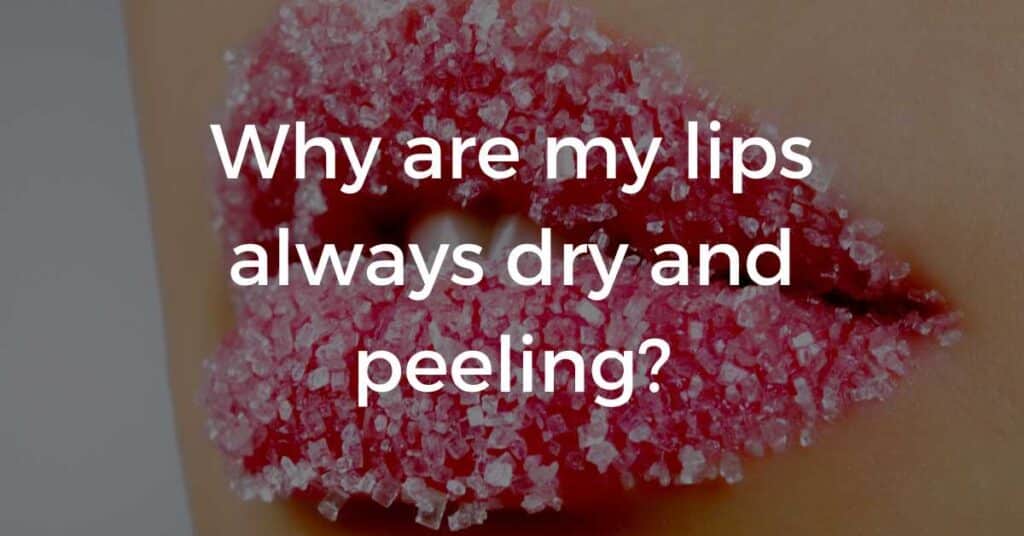 why-are-my-lips-always-dry-and-peeling-fitfab50