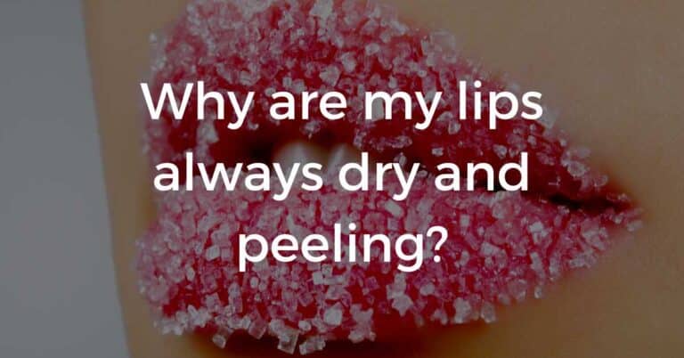 Why are my lips always dry and peeling?