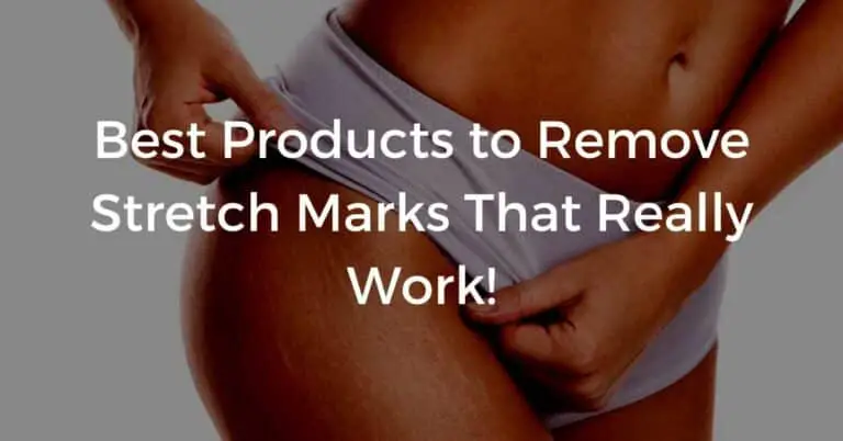 cellulite on hip area. Best Products to Remove Stretch Marks