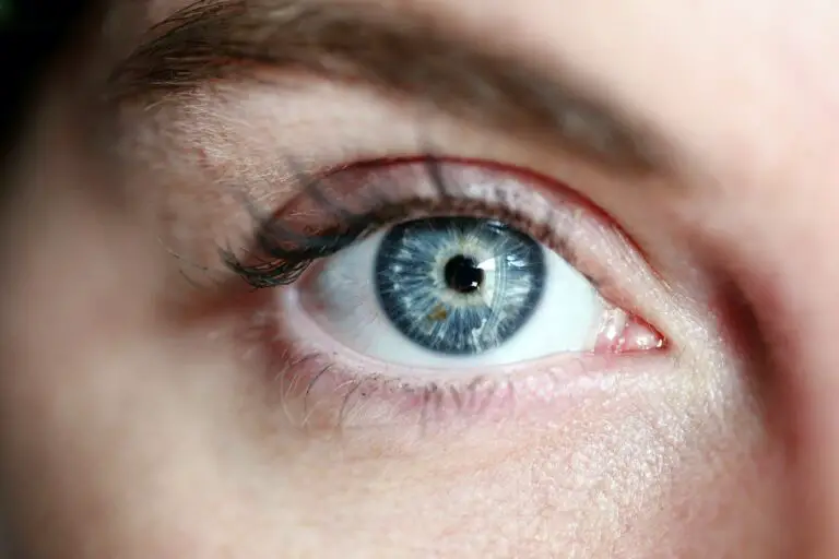 eye, blue eye, woman - Can Dark Circles Under Eyes Be Removed