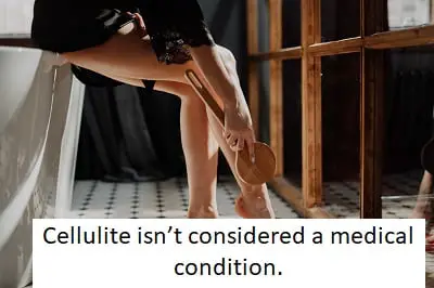 cellulite isn't considered a medical condition