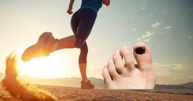 Protecting Your Toenails While Running