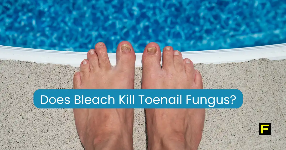 Does Bleach Kill Toenail Fungus? Featured image