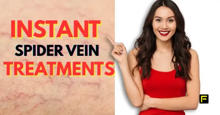 Best Makeup to Hide Spider Veins on Face Featured image