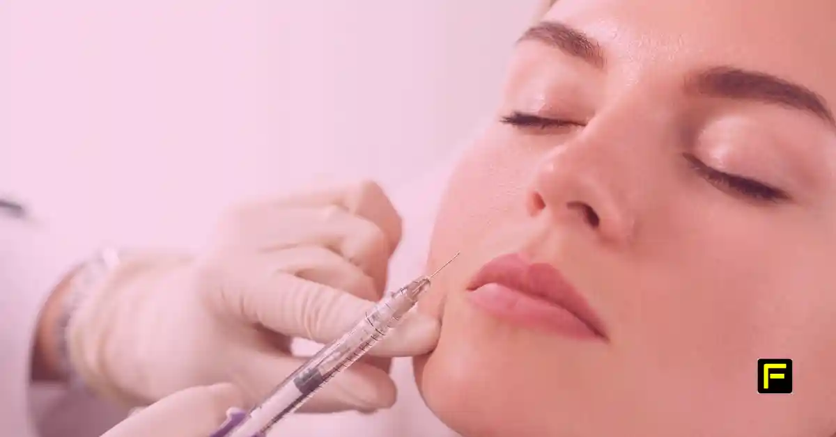 Dermal Fillers After 50. Featured image.