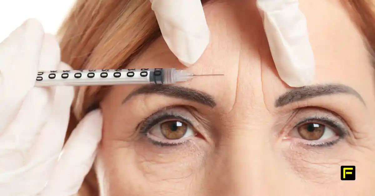 Botox after 50. Featured image