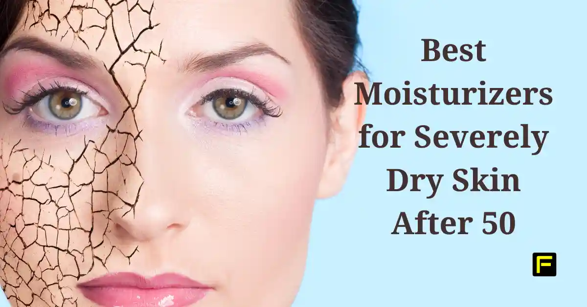 Best Moisturizer for Severely Dry Skin After 50. Featured image.
