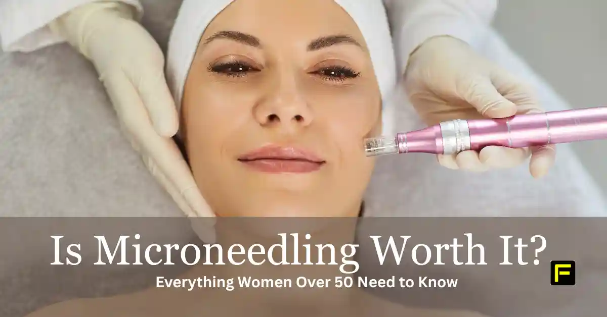 Is Microneedling Worth It? Featured image.