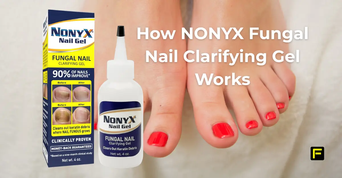 How NONYX Fungal Nail Clarifying Gel Works. Featured image.